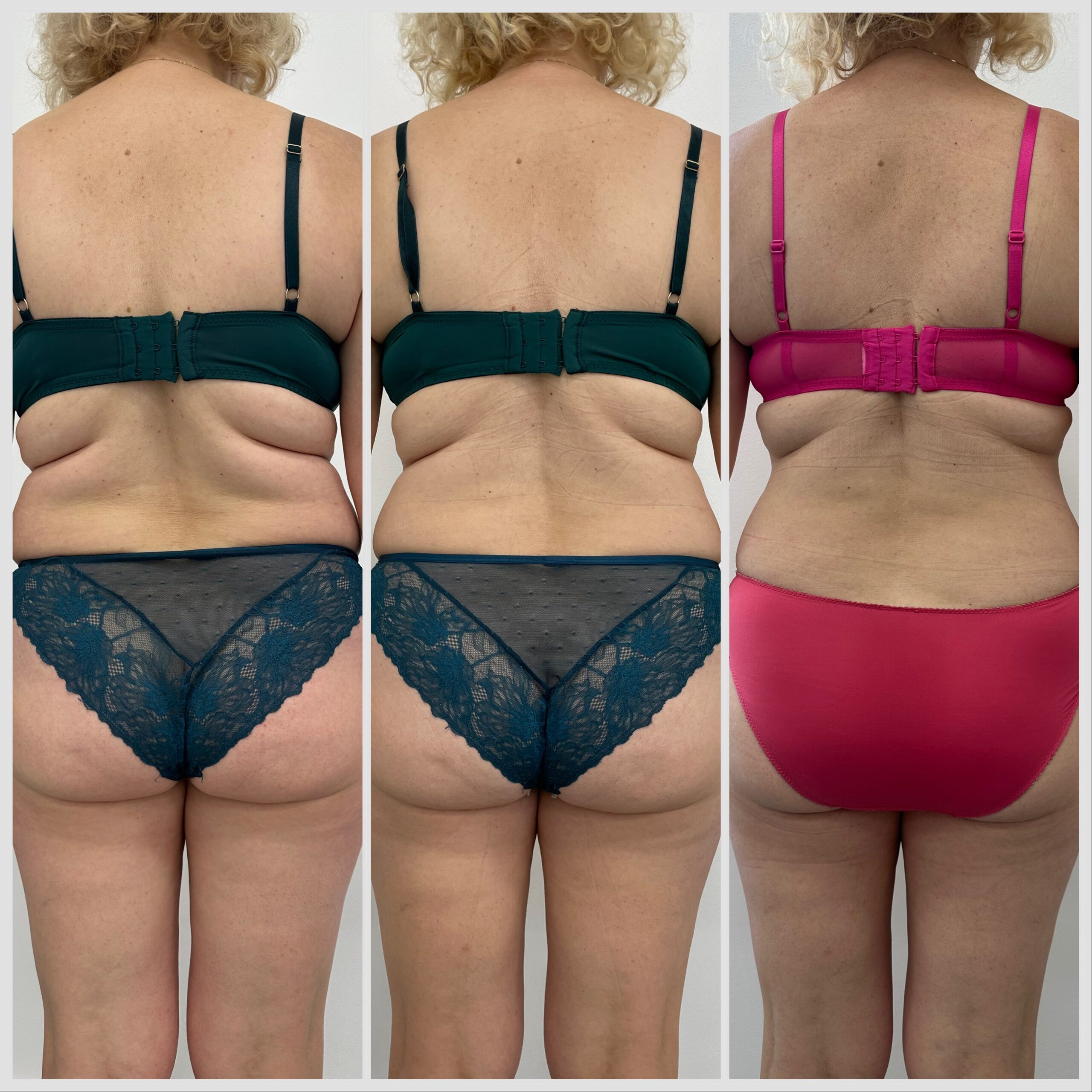 8x sezení s EMS bodysculpt