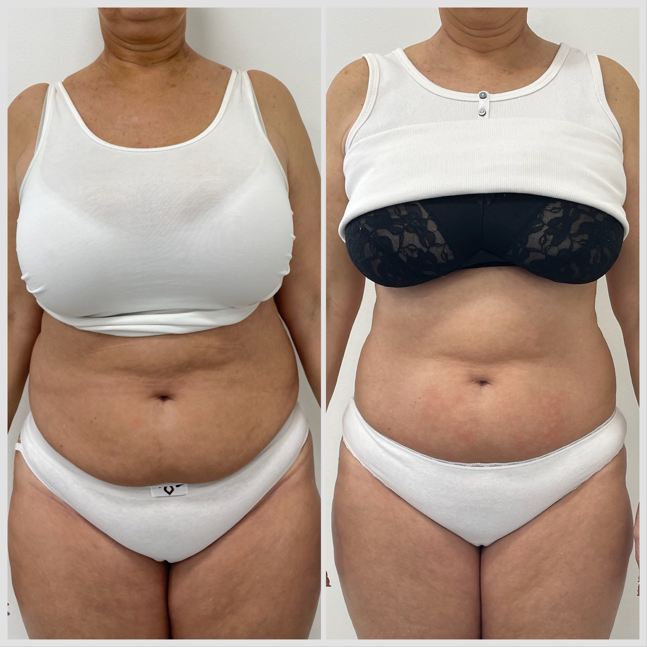 72B4B58B-14D1-45B3-AFD7-9B92A41CE3E5